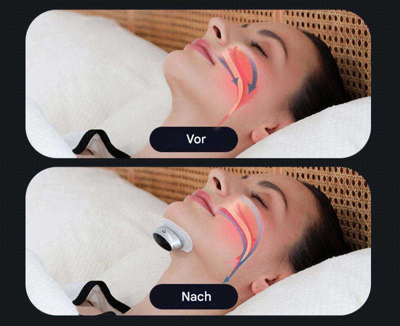 Dilatatore nasale in silicone per la notte